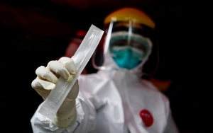 Antisipasi Corona Meluas, Puskesmas Kini Bisa Layani Tes Swab Tenggorokan