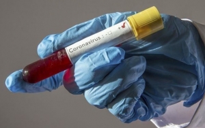 AS Sumbang Puluhan Miliar Demi Tangani Pandemi Corona di Indonesia