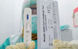 Ternyata Ini Kelebihan Alat Rapid Test Buatan Anak Bangsa Dibanding Hasil Impor