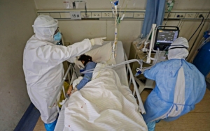Warna Kulit 2 Dokter Wuhan Menghitam Usai Kritis Karena Covid-19, Ini Dugaan Penyebabnya