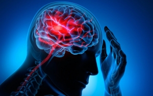 COVID-19 Dapat Sebabkan Stroke, Ini Penjelasan Dokter Amerika