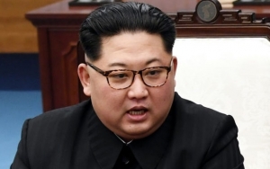 Tiongkok Eksklusif Kirim Tim Ahli Medis ke Korea Utara untuk Cek Kondisi Kim Jong Un