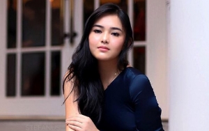 Biasa Hidup Mewah, Amanda Manopo Ngaku Ingin Berubah Efek Corona