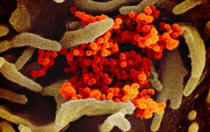 Penelitian Ungkap Virus Corona Serang Sel-Sel Ini Di Dalam Tubuh Pasien