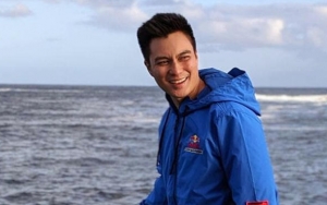 Baim Wong Nekat Lakukan Operasi Mata di Tengah Pandemi Covid-19