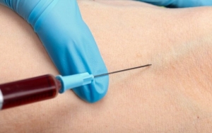 Gejala Baru Virus Corona Bisa Sebabkan Gumpalan Darah, Ini Fatalnya Bagi Organ Tubuh
