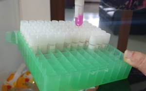 Sampel COVID-19 Terus Bertambah dari 4 Provinsi, Lab di Palembang Kelebihan Kapasitas