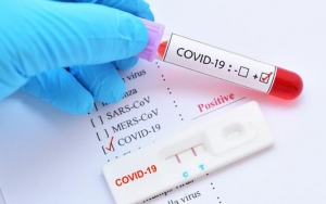 Jurnalis di Bengkulu Tak Sadar Wawancarai Orang Positif Corona, Pemda Kena Kritik