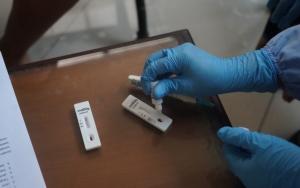 Alat Rapid Test yang Dipakai Warga Satu Desa di Bali Diduga Beri Hasil Positif Palsu