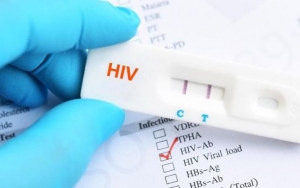 Bahaya Lockdown Kala Corona Tingkatkan Infeksi Kasus HIV, Kok Bisa?