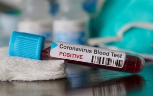 WHO: Virus Corona Mungkin Tak Akan Bisa Hilang