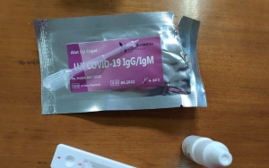 Ilmuwan Jabar Sukses Ciptakan Alat Rapid Test Corona Lokal, Hasilnya 80 Persen Akurat