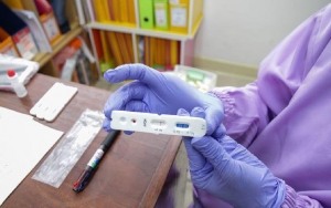 RI Sukses Lampaui 10 Ribu Tes Corona Per Hari, Ini Pesan Epidemiolog
