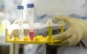 Badan Kesehatan AS Janji Bakal Bagikan Vaksin Virus Corona ke Seluruh Dunia