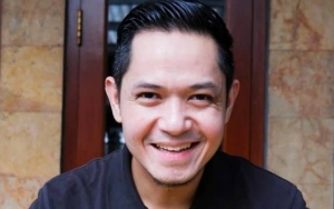 Pamer Wajah Tampan Hasil Oplas Challenge, Dude Harlino Siap Casting Film Hollywood