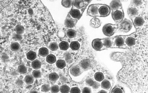 Vietnam Digegerkan Oleh Virus DIV1 Usai 'Menang' Lawan Corona, Apa Itu?