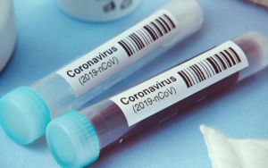Kawanan Monyet Curi dan Makan Sampel Corona dari Laboratorium India