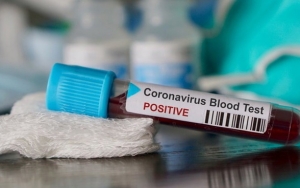 Tingkat Infeksi Corona Disebut Terpengaruh Golongan Darah, Lembaga Eijkman Buka Suara 