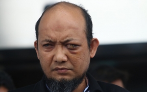 Wajah Baik-Baik Saja Usai Disiram Air Keras, Novel Baswedan Beri Penjelasan 