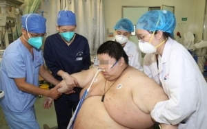 Viral Seorang Pria Berat Badannya Naik Hingga 279 Kilogram Usai 5 Bulan Lockdown di Wuhan