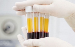 RS Bandung Ini Andalkan Terapi Plasma Konvalesen Untuk Sembuhkan Pasien Corona, Efektif?
