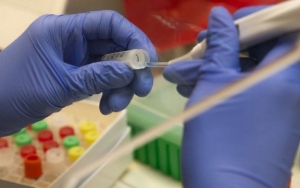 WHO Akhirnya Setuju Selidiki Sumber Virus Corona di Tiongkok