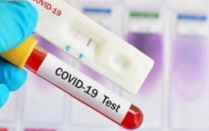 Alat Rapid Test Buatan RI Siap Diproduksi, Menko PMK Usul Harganya Rp 75 Ribu
