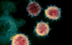 Virus Corona Dapat Menular Lewat Mikrodroplet, Beda Dengan Airborne?