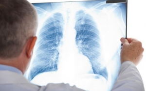 Kazakhstan Bantah Klaim Tiongkok Soal Wabah Pneumonia yang Lebih Mematikan Dari COVID-19