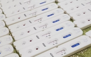 Alat Rapid Test Sudah Dikembangkan, Industri RI Masih Maju Mundur Buat Produksi