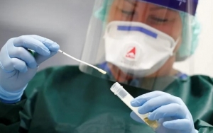 Kematian PDP-ODP Corona Tinggi, WHO Minta RI Perbanyak Tes Swab Massal