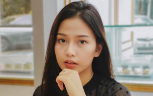 Dara Arafah Oplas Hidung Sampai Rp 100 Juta, Jawab Begini Saat Penampilan Diledek Seperti Banci