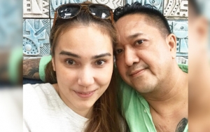 Momen Feby Febiola Botakin Rambut Franky Sihombing Sampai Plontos Banjir Semangat dari Rekan Artis