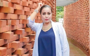 Rency Milano Jadi Korban Malapraktik Hingga Dagu Bolong, Ternyata Endorse?