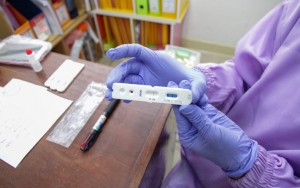 Kimia Farma Janjikan Rapid Test di Bawah Rp 100 Ribu, Siap Meluncur Bulan Depan?