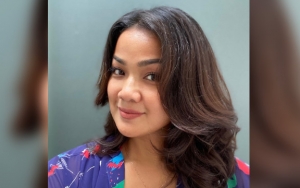 Nirina Zubir Unggah Foto Kaki Terluka dan Penuh Memar, Kenapa?