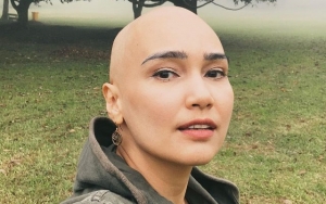 Feby Febiola Sempat Buat Cemas Setelah Umumkan Idap Kanker, Beberkan Kondisi Terkini