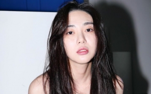 Agensi Langsung Kirim Tim Medis Usai Mina Eks AOA Unggah Foto Lukai Diri Sendiri