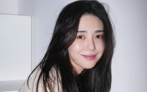 Mina Eks AOA Lukai Diri Hingga Dilarikan ke UGD, Pihak FNC Entertainment Sampaikan Permintaan Maaf