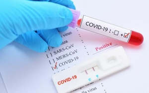 Rapid Test Antigen Disebut Lebih Akurat, Begini Respon LIPI