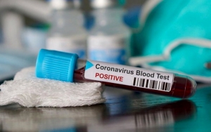 Mengejutkan, Hoaks Virus Corona Sebabkan 800 Orang Meninggal