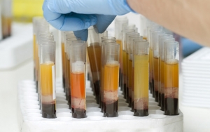 KSAD Andika Perkasa Siap Hibahkan Plasma dari Klaster Secapa Bandung untuk Terapi Pasien Corona