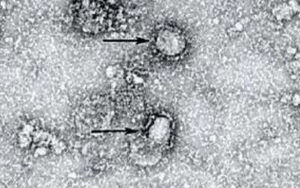 Malaysia dan Filipina Diguncang Virus Corona yang 10 Kali Lebih Menular, Berpotensi Masuk Indonesia?
