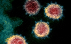 Malaysia Dihantui Virus Corona Yang 10 Kali Lebih Menular, Pakar Nilai Wajar Karena Hal Ini