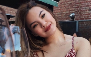 Putus dari Bastian Steel, Shafa Harris Makin Cantik dan Seksi Pamer Bibir Merah