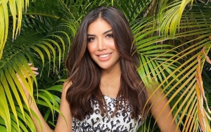 Millendaru Perbesar Ukuran Bibir dan Bokong Ala Kim Kardashian Disebut Makin Seram