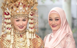 Dinda Hauw Dicap Menor Seksi, Wajah Imut Kakak Ipar Dipuji Bak Putri Bangsawan