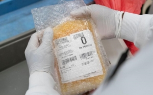Badan Obat-Obatan AS Setujui Terapi Plasma Darah, Bantah Diperintah oleh Trump