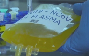 WHO Beri Peringatan Soal Terapi Plasma Darah untuk Lawan COVID-19