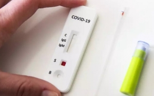 Dikritik Buang-Buang Uang, Satgas COVID-19 Ungkap Pemerintah Tak Pernah Beli Alat Rapid Test